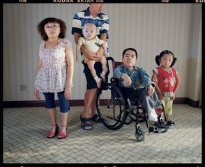 成骨不全怎么治疗？