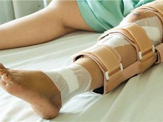 玖玖骨科小知识：四肢骨折的治疗原则及目的是什么 