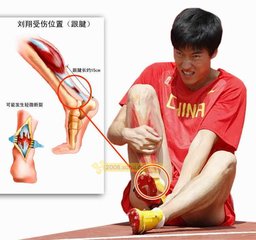 什么是跟腱断裂？应该怎么治疗？
