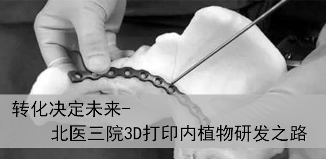 转化决定未来-北医三院3D打印内植物研发之路