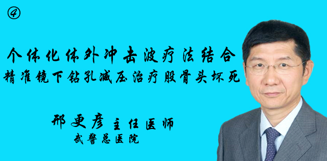 <b>个体化体外冲击波疗法结合精准镜下钻孔减压治疗股骨头坏死4</b>
