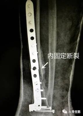 这么结实的钢板还能断？